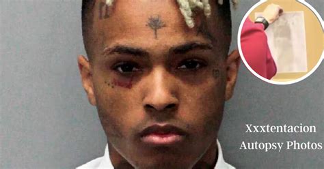 Jahseh Onfroy (XXXTentacion) Autopsy Report